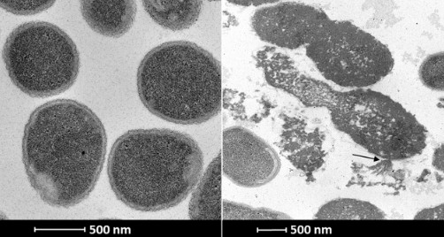 Zdjęcie z transmisyjnego mikroskopu elektronowego ukazujące komórki bakterii Acintobcater baumannii przed (po lewej) oraz po potraktowaniu ich endolizyną Ts2631 (po prawej). Endolizyna dostała się przez błonę zewnętrzną bakterii i zdegradowała peptydoglikan w związku z czym można zaobserwować wypływającą wewnątrzkomórkową zawartość bakterii.