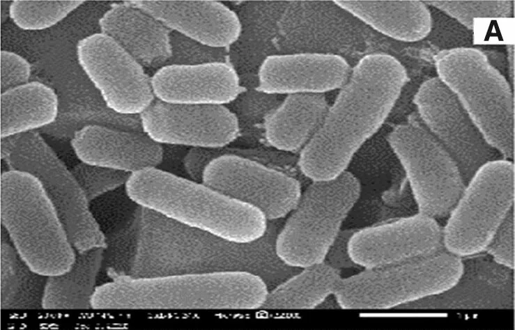 Lactobacillus acidophilus